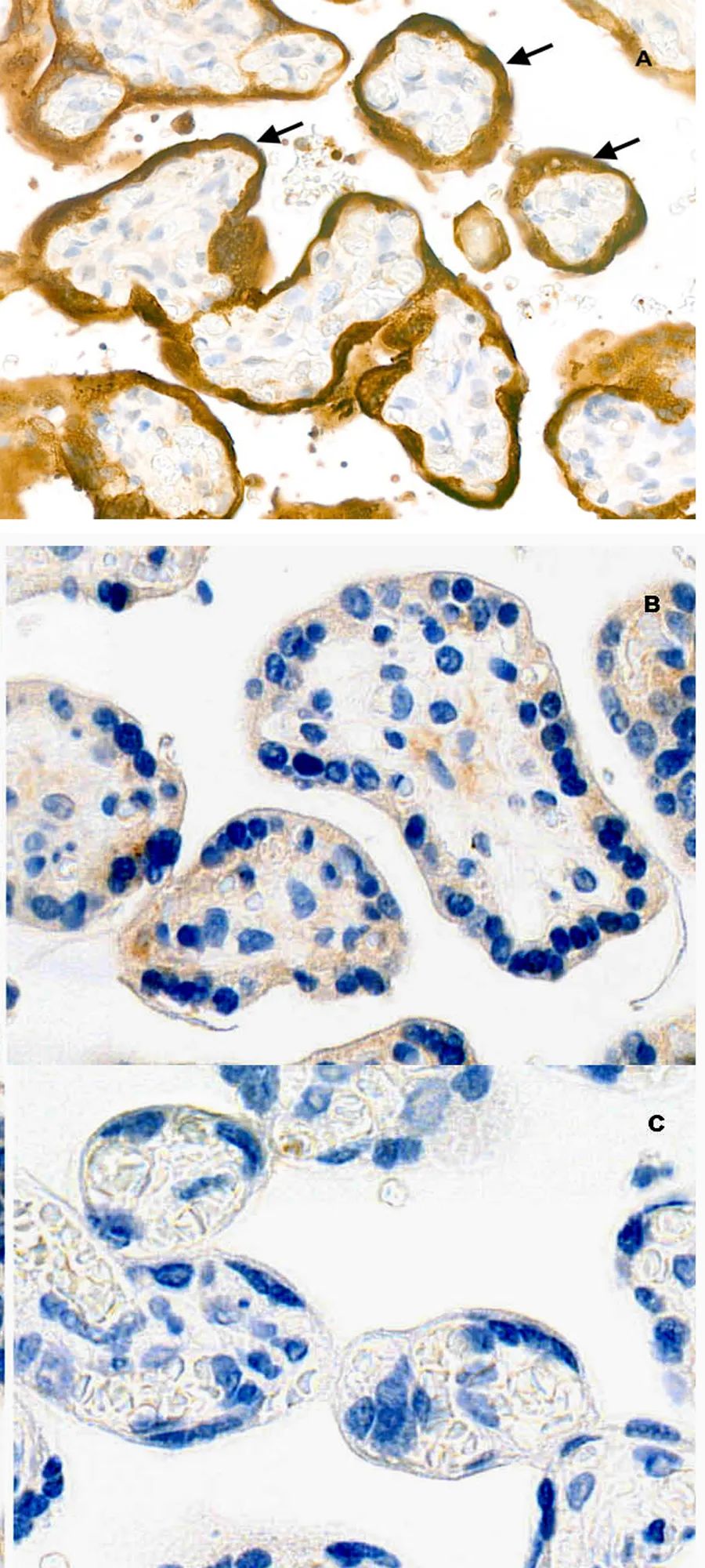 新冠病毒可通过母婴垂直传播吗？
