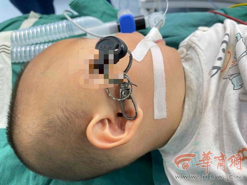西安男孩骑自行车摔倒撞倒孩子,2岁男童意外摔倒