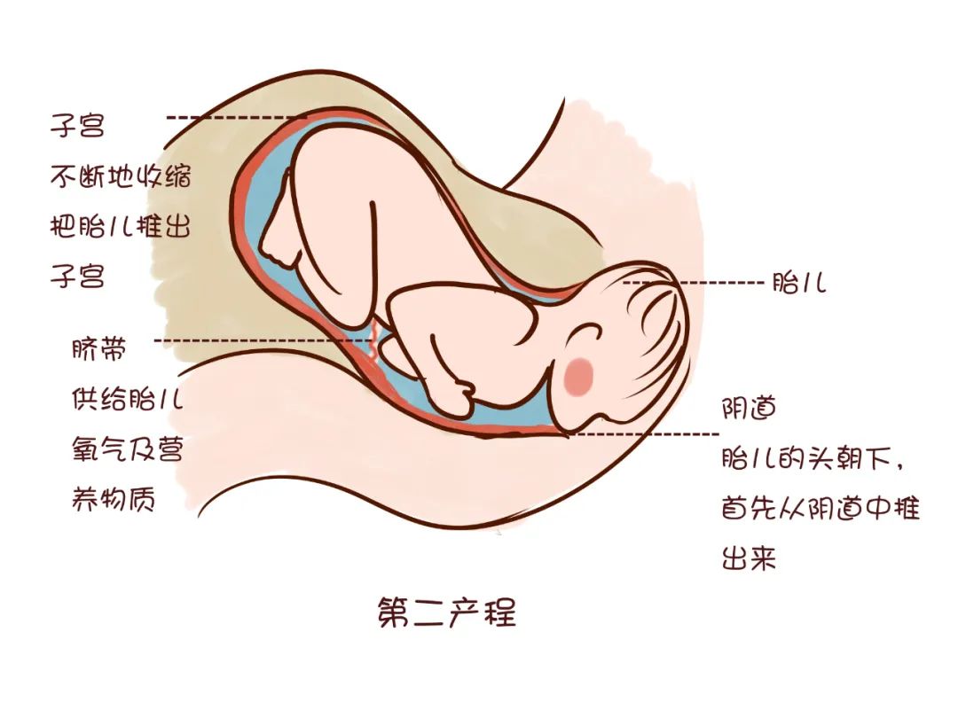 分娩镇痛的实施方案,分娩镇痛怎么做