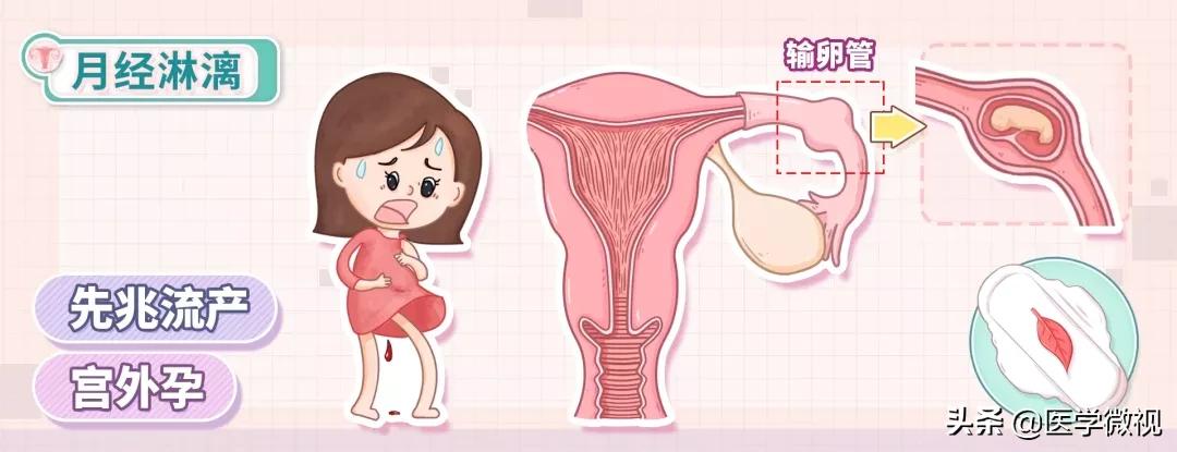 月经推迟鲜红色是怎么回事,月经出现暗红色是什么原因