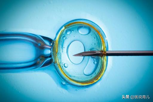 结扎两年了想要宝宝需要注意什么,结扎后能否再生育