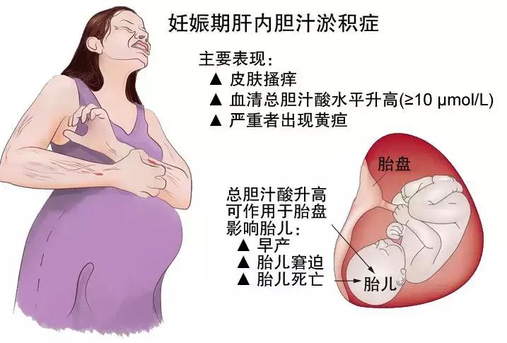 冬日里的漂亮准妈妈