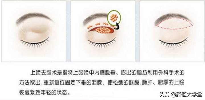 歌手黄霄云整容过吗,黄霄云参加歌手淘汰了谁