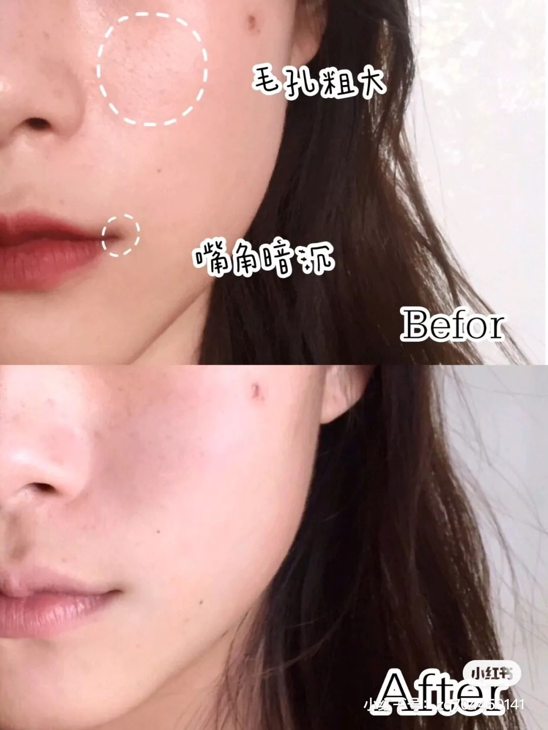 我用空瓶了几十瓶面霜的经验告诉你，谁才是真正的干皮亲妈