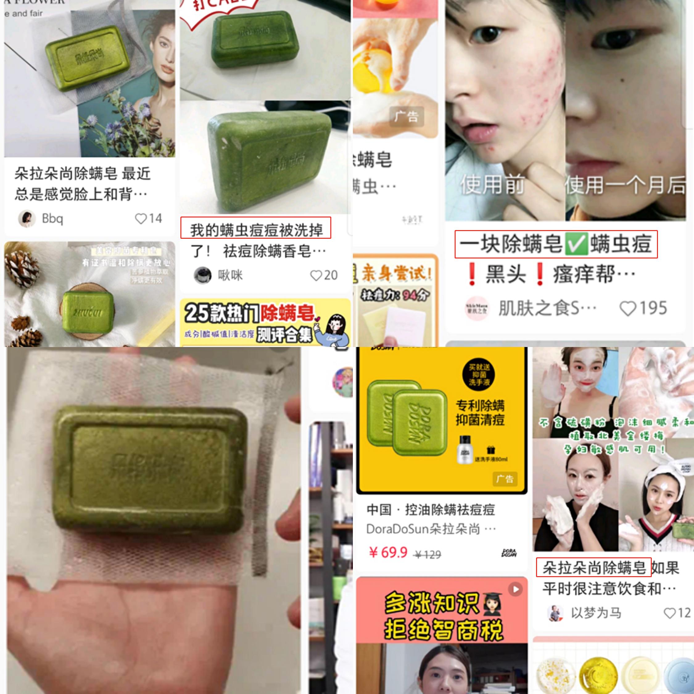 皮肤老是冒痘为什么会痒,皮肤经常起痘洗澡了之后就好了
