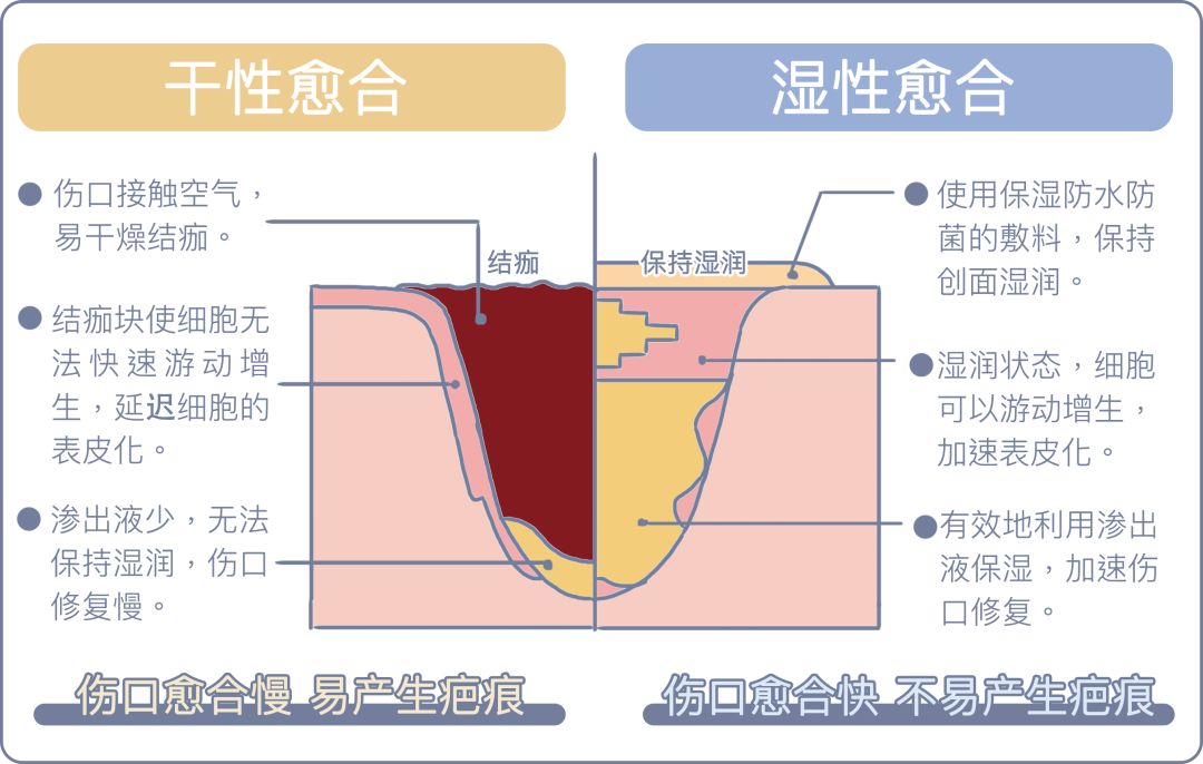 伤口结痂了是好是坏,伤口反复结痂不愈合容易患癌