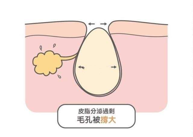 脱发毛囊没闭合怎么治疗,脱发毛囊闭合怎么办