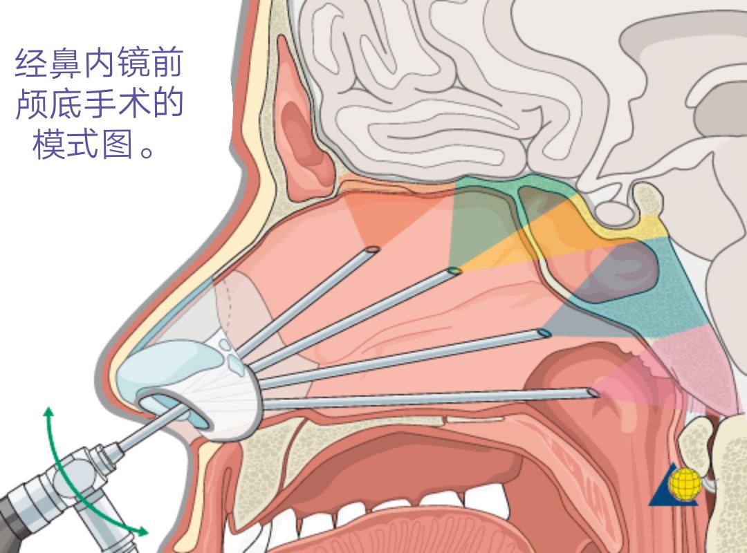 垂体前叶功能减退护理诊断及措施,垂体前叶功能减退症的诊疗流程图