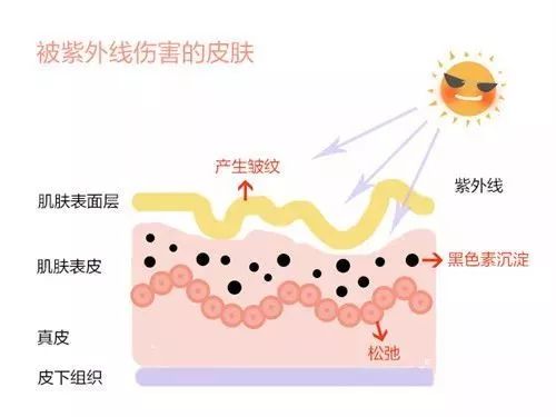 脸上的黑色素怎么改善,脸上有黑色素用什么办法慢慢淡化