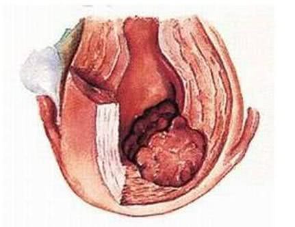 孕妇在葡萄架子下呆着不好吗,孕妇坐葡萄树下不好吗