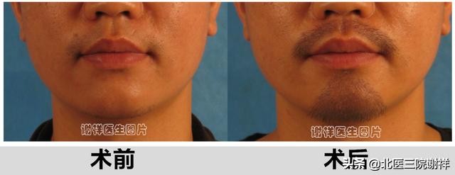 男性如何增加自己的魅力,男性提升魅力的捷径