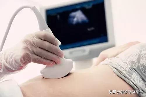 宝妈产检包括什么,宝妈必修锻炼课程