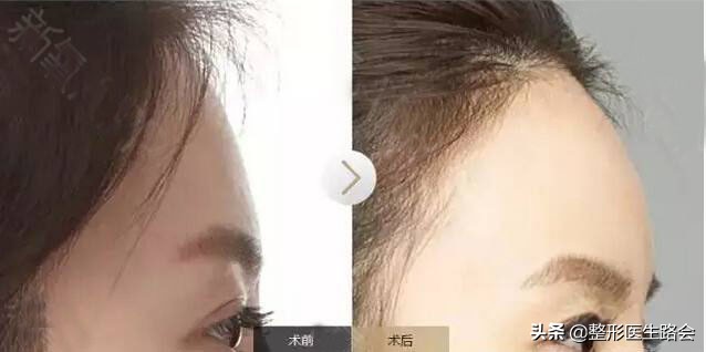 怎样看侧脸才是真实的侧脸,侧脸怎么样才算好看