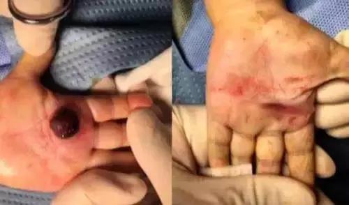 偏方生吞活泥鳅,生吞泥鳅偏方治好了