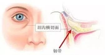 眼袋泪沟黑眼圈卧蚕是怎么形成的,如何分清楚卧蚕泪沟眼袋黑眼圈