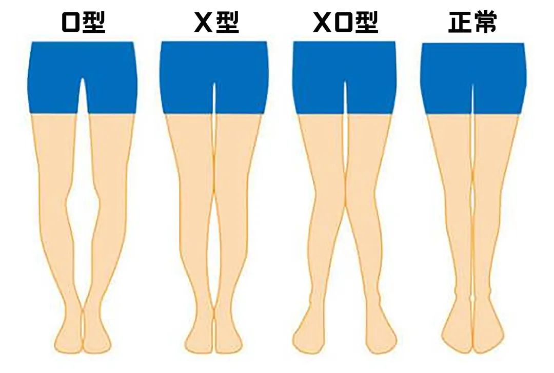 女生腿粗有小肚子怎么穿丨改造间
