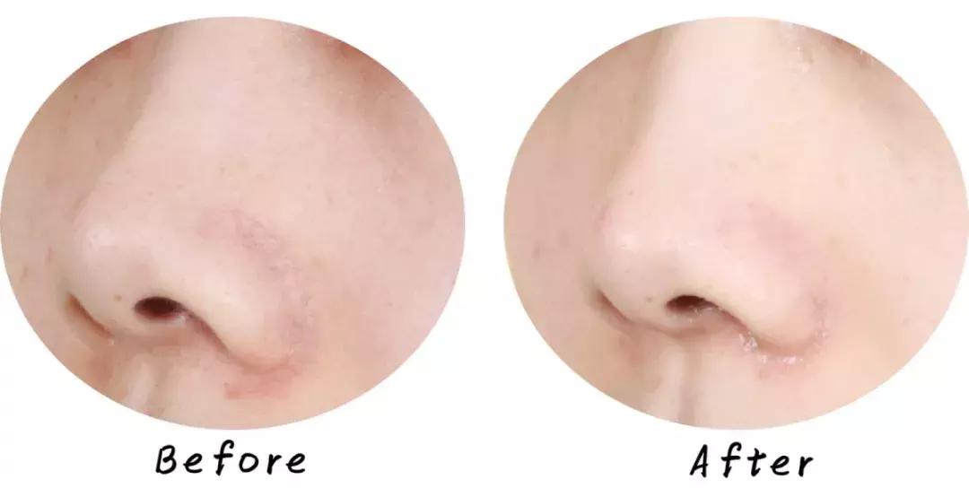 swisse麦卢卡蜂蜜排毒清洁面膜,超温和清洁面膜推荐哪个