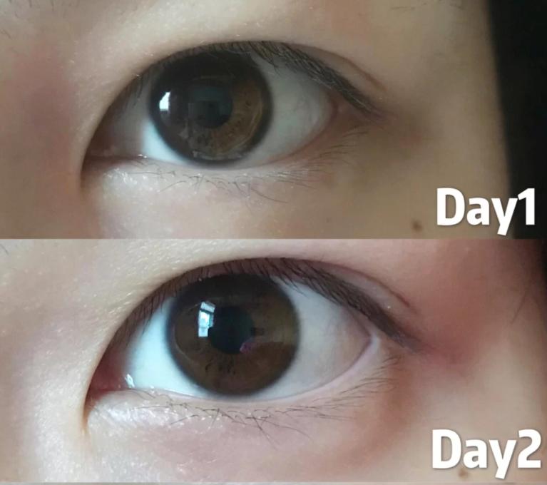 脸上的小瑕疵用什么护肤品比较好,脸部护肤的十大误区