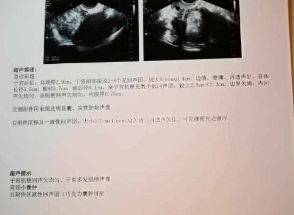 子宫腺肌症可以吃妇科再造丸吗,妇科子宫腺肌症最佳治疗方法
