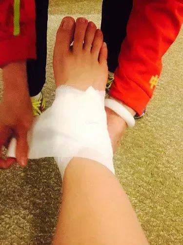 扭伤拉伤处置,扭伤拉伤治疗手法