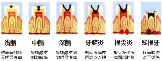 口臭时隐时现，刷牙漱口无作用，牙医教你几个小妙招轻松去口臭