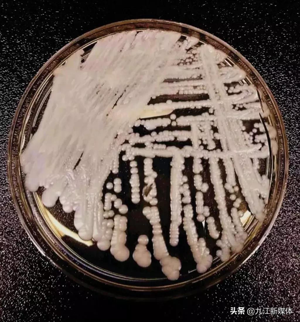 真菌感染一览表,最可怕的真菌感染