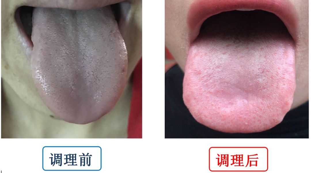 经期必吃止痛药，手脚冰凉还怕冷？你知道宫寒的真正原因吗