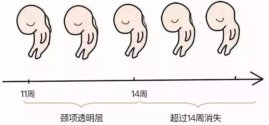 做nt产检胎儿差不多有多少毫米,产检nt检查出增宽3.4毫米正常吗