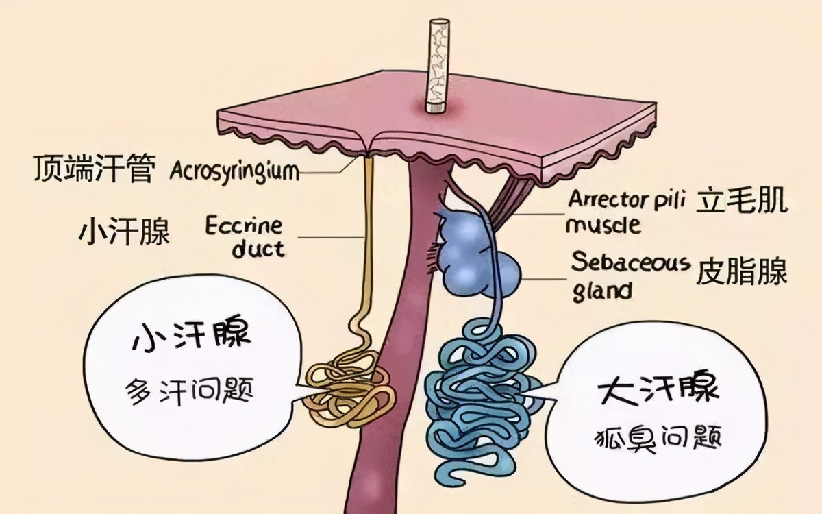 狐臭是怎么引起的,狐臭是怎么引起的啊