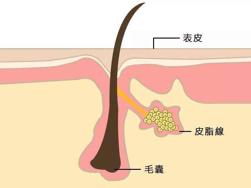 青少年女生满脸痘怎么治,花季少女如何不长痘痘