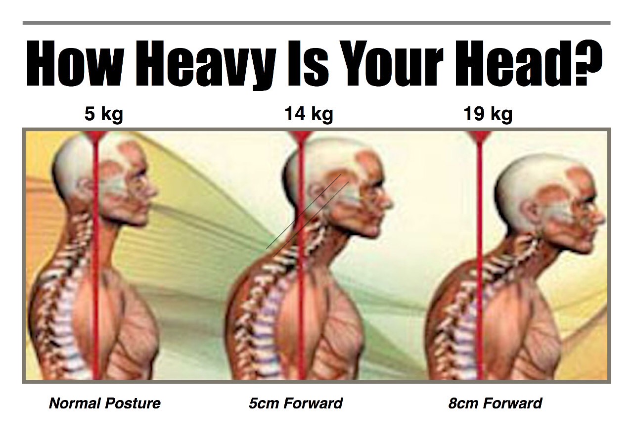 颈椎康复就一招,改善颈椎的有效缓解方法