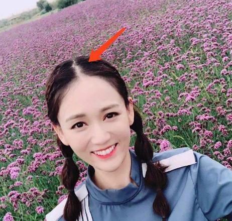 沙宣洗发水洗了脱发,沙宣洗发水洗了掉头发严重