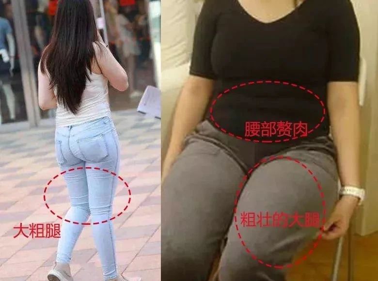 站立臀部凹陷假胯宽最有效的锻炼,避免臀凹陷和假胯宽的正确坐姿