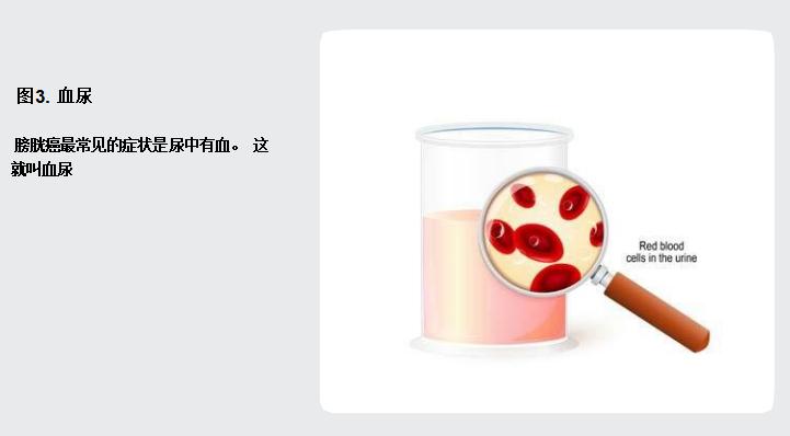 谈癌色变的治疗方法,谈癌色变是什么病