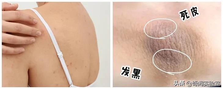 背部搓澡的方法,一个人搓澡怎么搓到后背
