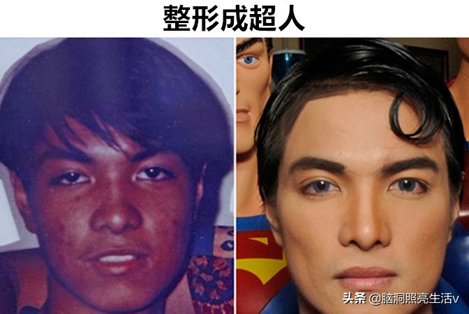 明星模仿秀最像的人图片,疯狂整容把自己整成丑八怪