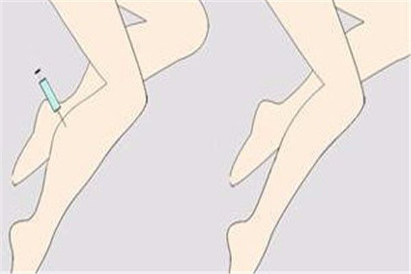郑爽同款漫画腿不动刀也能get？吴昕的萝卜腿有救了