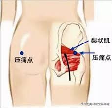 跑步导致大腿根疼是怎么回事,长期跑步后膝盖有刺痛感