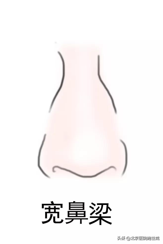 天生鼻型不完美怎么办呢,八种鼻型不佳图片