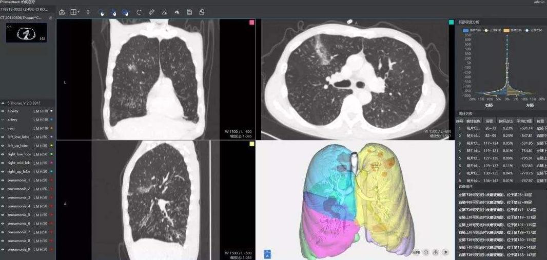 哪些国家有儿童感染新冠病毒的,现在新冠病毒儿童最新症状