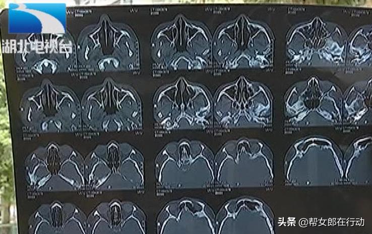 艺星医疗美容医院鼻子,艺星医疗美容医院做鼻子要多少钱