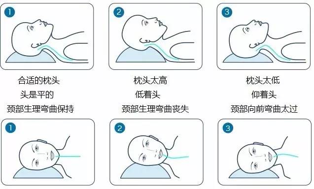枕头选的好睡,枕头你选对了吗颈椎枕