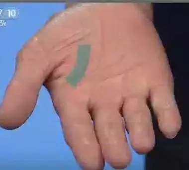 手上7个小细节竟然隐藏大健康,手诊10种常见病从手上就能看出来