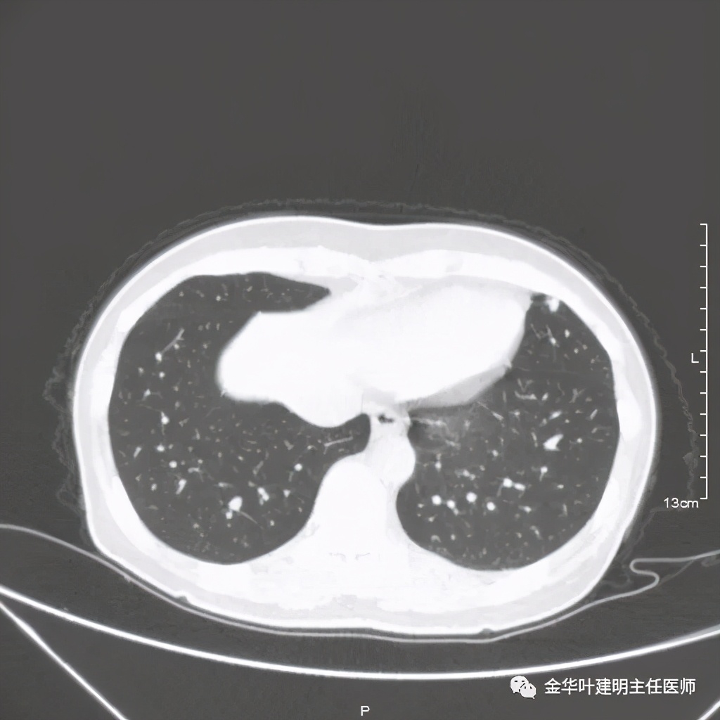 放个大招完整版教学,放个大招完整版前奏