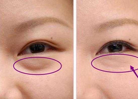 护理眼膜的眼霜,眼胶眼霜眼膜哪个好