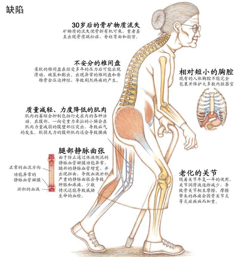 骨质疏松喝牛奶吃钙片有用吗,氨糖软骨素钙片对骨质疏松有用吗