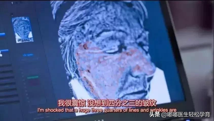 褪黑素和葡萄籽效果,葡萄籽褪黑素的功效和副作用