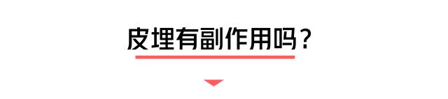 小小一根棒，比套套和上环安全，避孕率超高却少有人知道...