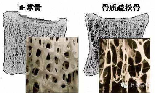 更年期雌激素下降吃啥补雌激素,雌激素下降会导致什么