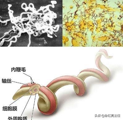 【性病那点事】正确看待梅毒的感染和传播